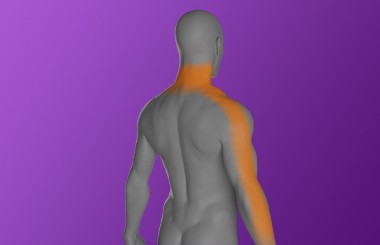 Neck_pain_with_upper_limb.jpg